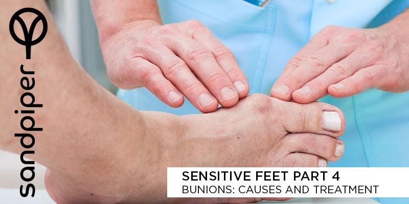 Bunions:Causes and Treatment