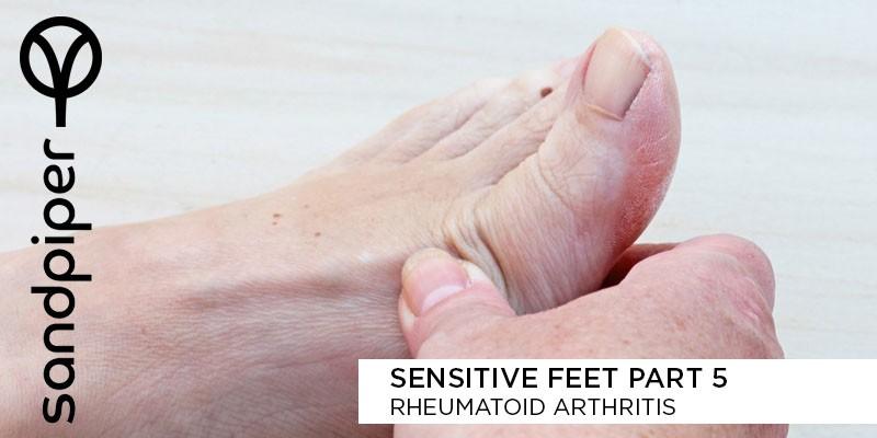 Rheumatoid Arthritis