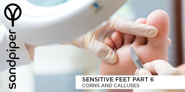 Corns and Calluses